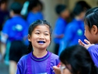 โครงการ ฟ.ฟัน สวยยิ้มใส ปีการศึกษา 2569 Image 95
